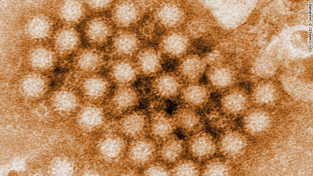 ノロウイルスの感染が広がっている＝CDC/CHARLES D. HUMPHREY提供