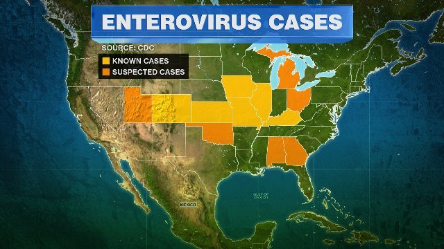 中西部流行していたエンテロウイルスがニューヨーク州でも確認された
