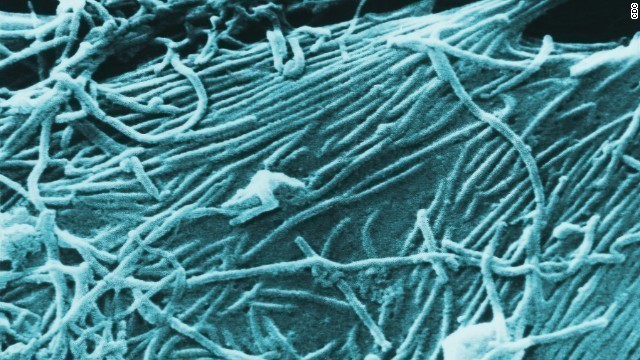 エボラウイルス。シエラレオネで感染した男性が米ダラスの病院に搬送された＝CDC提供