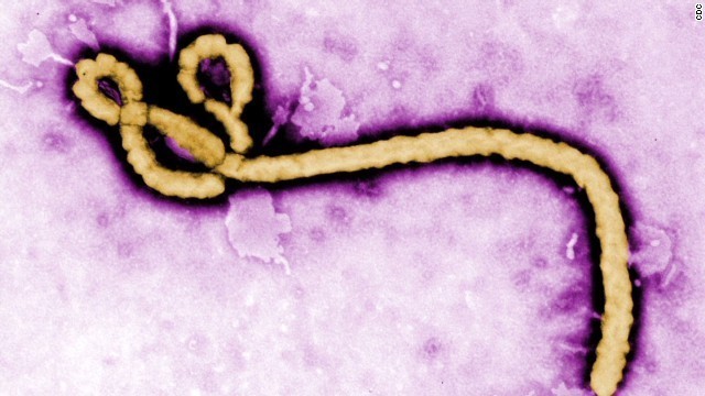 エボラウイルス。シエラレオネに渡航した英国人女性が感染し重体に＝ＣＤＣ提供
