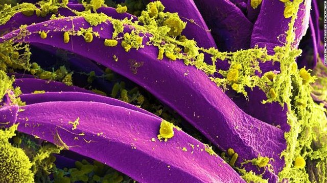 ノミが媒介するとされるペスト菌＝米国立アレルギー・感染症研究所