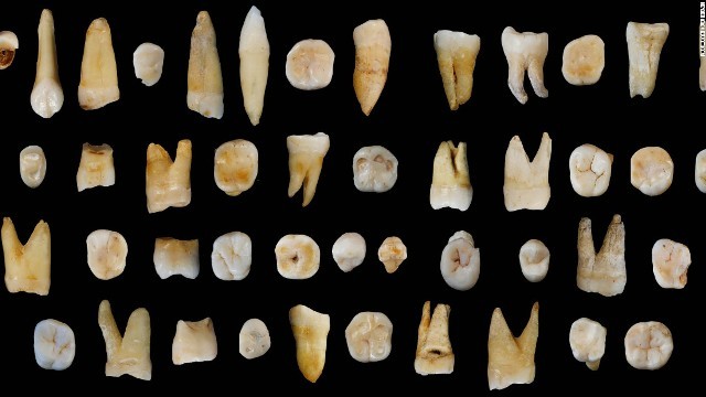 見つかった歯の化石は８万～１２万年前にさかのぼると推定される＝LIU WU AND WU XIUJIE