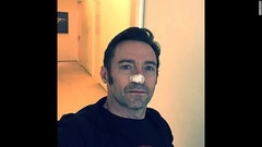 鼻の皮膚がんの治療を報告する俳優のヒュー・ジャックマン