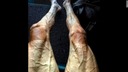 ツール・ド・フランス、選手がレース後の「脚」画像を公開　