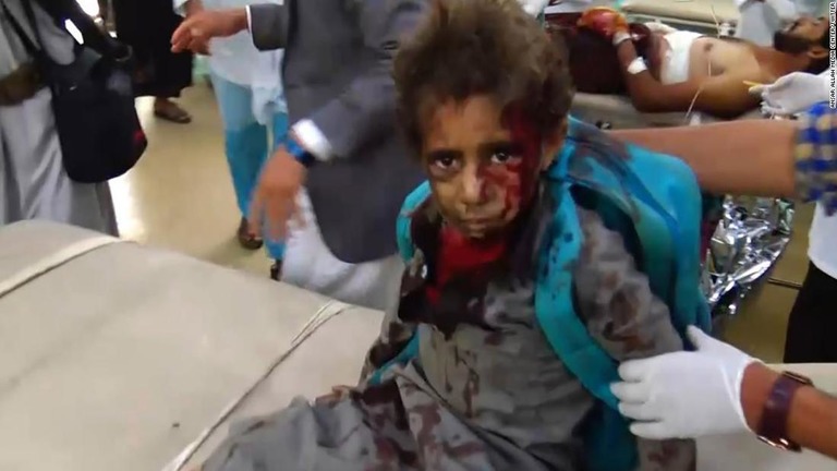 子どもたちを乗せたバスがサウジアラビア率いる有志連合の空爆に遭い多数の死傷者がでた/Ansar Allah Media Center/Twitter