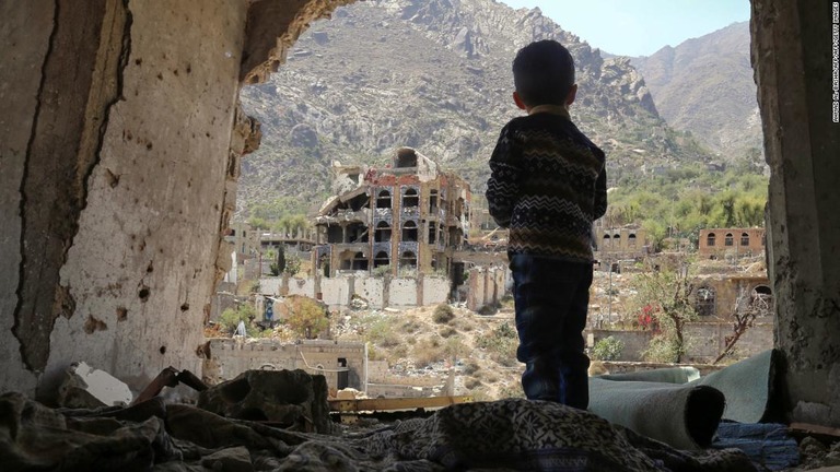 イエメンの２０００万人が飢えに苦しみ、子ども１８００万人が急性栄養失調に陥っている