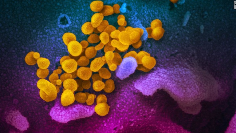 米国での新型コロナウイルスの感染者が１日で１５０人増え、７１７人に達した/NIAID-RML