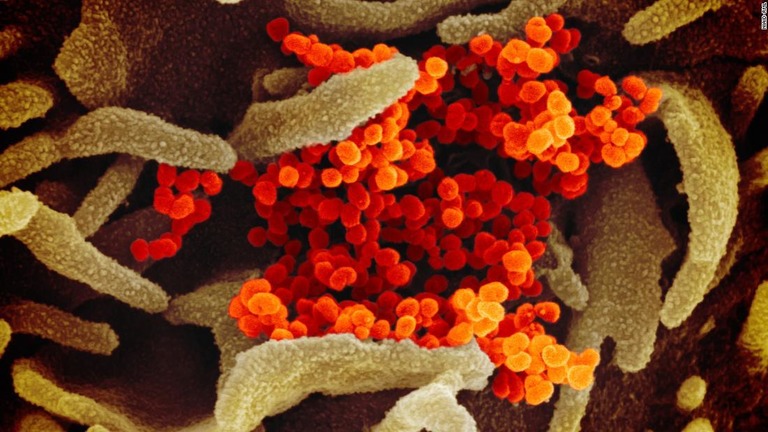 電子顕微鏡が映し出した新型コロナウイルス（オレンジ色の部分）/NIAID-RML