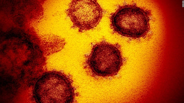 透過型電子顕微鏡で撮影した新型コロナウイルス/NIAID-RML