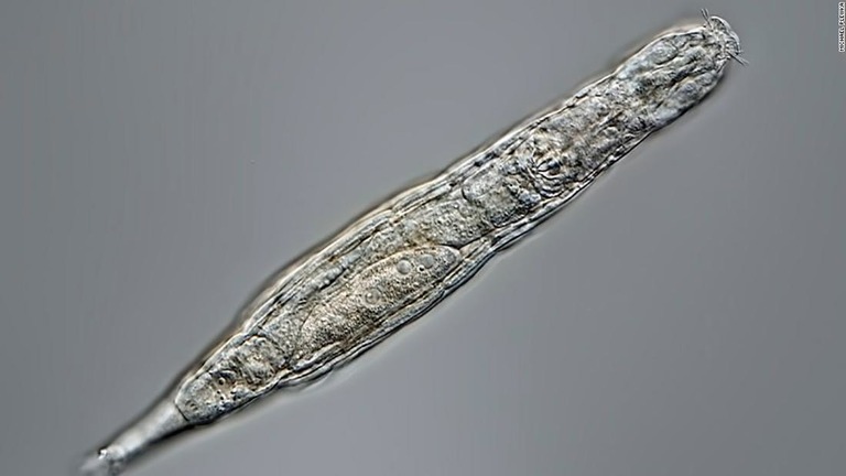 永久凍土での２万４０００年の眠りから微小生物「ヒルガタワムシ」が蘇生した/Michael Plewka