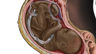 黒人の胎児を描いた医学イラストがＳＮＳで拡散した