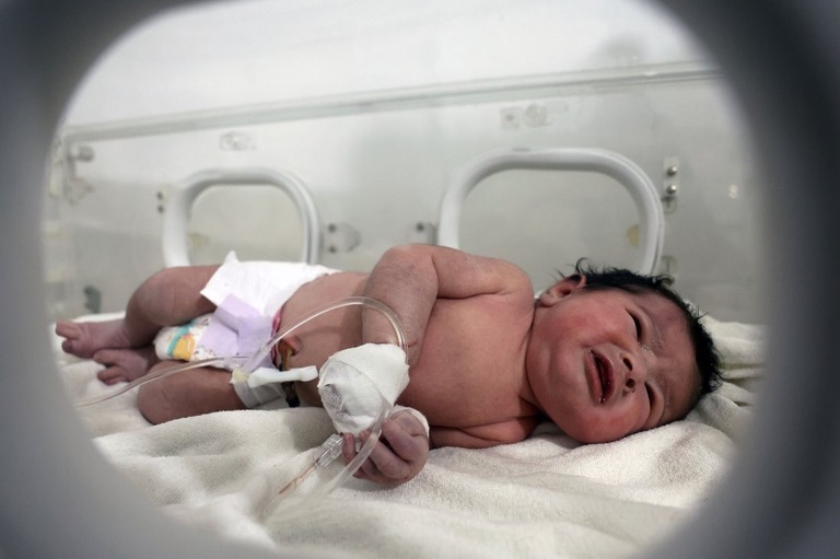 病院で手当てを受ける、がれきの中から救出された赤ちゃん＝７日、シリア・アフリン/Ghaith Alsayed/AP