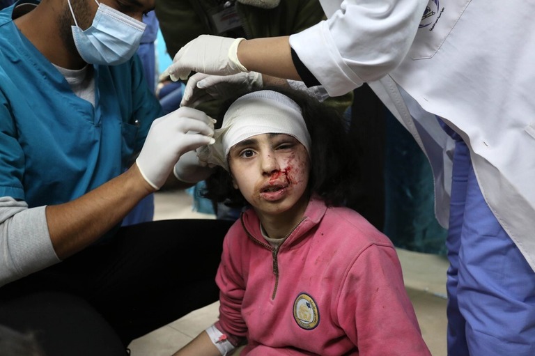 ヌセイラト難民キャンプでイスラエルの攻撃により重傷を負ったパレスチナの子ども＝５日、パレスチナ自治区ガザ地区の病院/Ashraf Amra/Anadolu/Getty Images