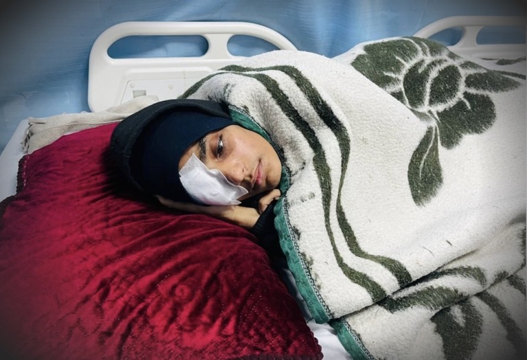 イスラエル軍の空爆で重傷を負ったローバ・アブ・ジッバ/CNN