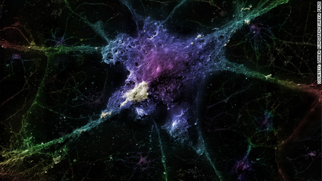 アルツハイマー病と神経細胞：アルツハイマー病の原因とされるアミロイドベーペプチドが付着した神経細胞。このサンプルはプラチナでコーティングされ、３２００倍に拡大されている＝Linnea Rundgren/Eureka Prize提供