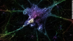 アルツハイマー病と神経細胞：アルツハイマー病の原因とされるアミロイドベーペプチドが付着した神経細胞。このサンプルはプラチナでコーティングされ、３２００倍に拡大されている＝Linnea Rundgren/Eureka Prize提供