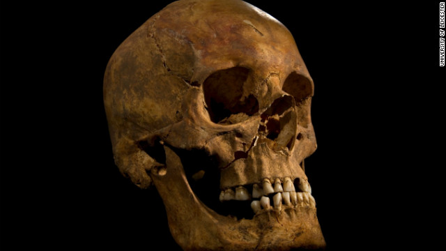 リチャード３世のものと確認された頭がい骨＝University of Leicester提供