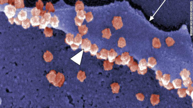 電子顕微鏡画像。ピンク色が「コロナウイルス」＝ＣＤＣ提供