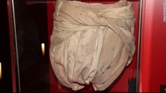 ８０年にブロードウェーなどで「エレファント・マン」に出演した時の衣装。パントマイムの技術を駆使して主人公ジョン・メリックの体を表現した
