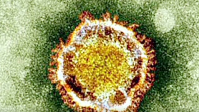 イタリアでも感染が確認された新型コロナウイルス