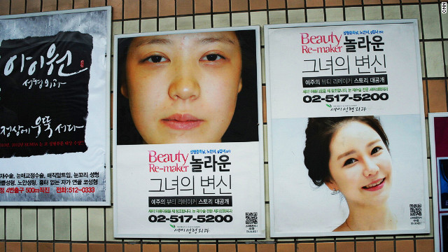 ソウル市内にある美容整形のポスター。韓国では女性の２０％が手術を受けるという