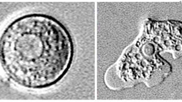 脳をむしばむ病原性アメーバ「ネグレリア・フォーレリ」＝ＣＤＣ提供