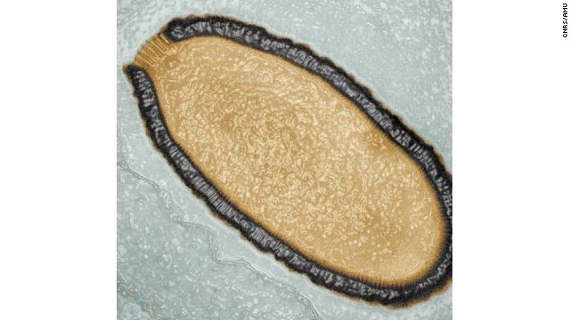 ３万年前の永久凍土から発見されたピソウイルス＝CNRS/AMU提供