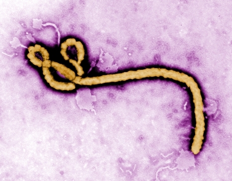 エボラウイルス＝CDC提供