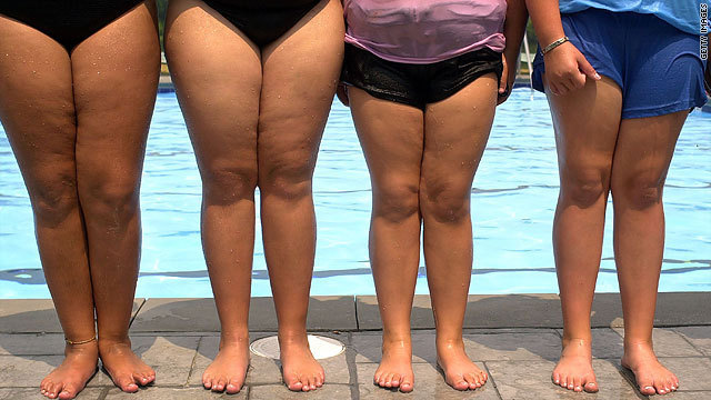 所得に比べて食品が割安になったのが肥満拡大の要因？