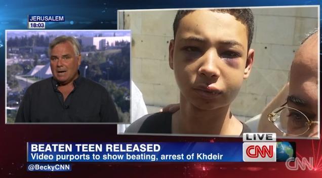 米国籍の１５歳の少年がイスラエル当局から暴行を受けたと家族が主張