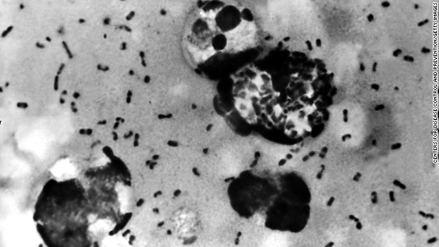 ペスト菌がペストを発症させる＝米疾病対策センター提供
