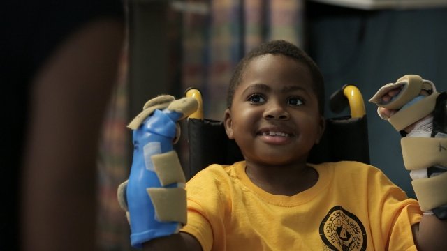 両手の移植手術を受けたザイオン・ハービー君＝Children's Hospital Philadelphia