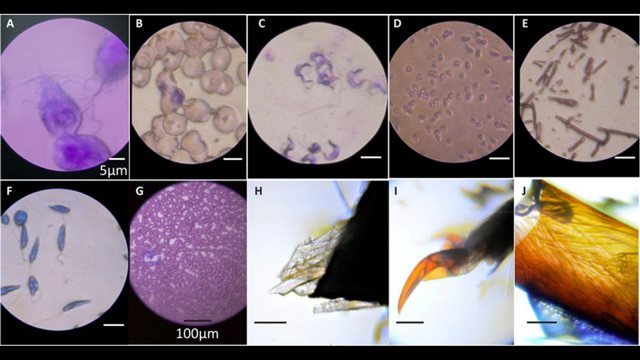 フォールドスコープを１万人に配布し観察結果を募った＝FOLDSCOPE TEAM