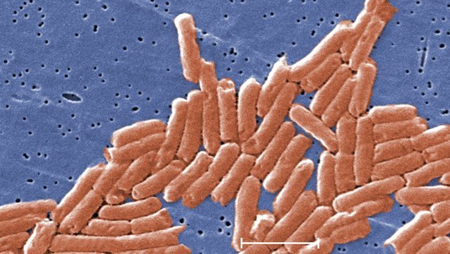 顕微鏡で見たサルモネラ菌＝米疾病対策センター（ＣＤＣ）