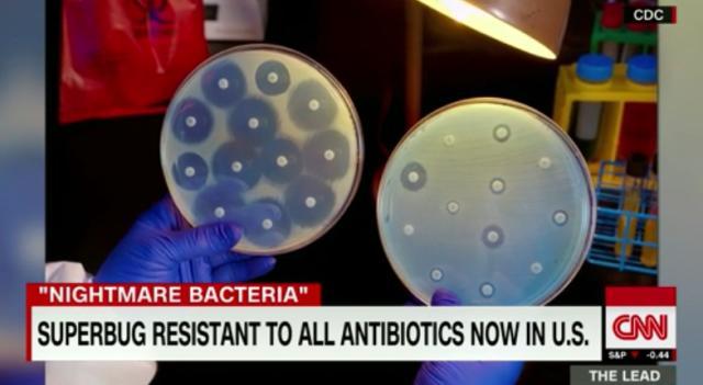 抗生物質への耐性を持つ細菌「スーパーバグ」の感染例が米国内で確認された＝CDC
