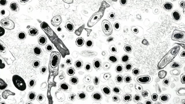 シベリアでは１９４１年以来、炭疽菌の感染拡大は起きていない