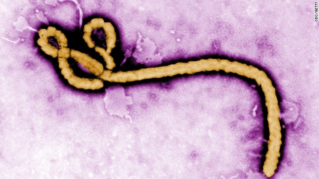 Cnn Co Jp エボラウイルスに接触か カナダの研究所で職員隔離 1 2
