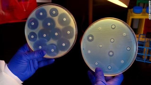 「カルバペネム耐性腸内細菌科細菌」に関する研究が進められている