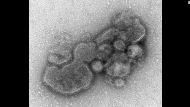 顕微鏡でとらえたＨ７Ｎ９型鳥インフルエンザウイルス
