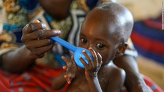 ニジェール：きれいな水を飲む急性栄養失調の赤ちゃん。５歳までの子どもの４３％が発育不全となっている