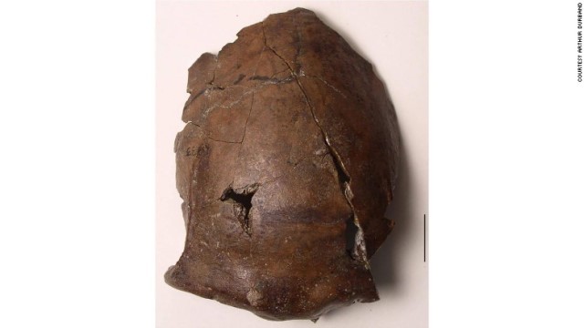 パプアニューギニアで６０００年前の頭蓋骨が見つかっていた