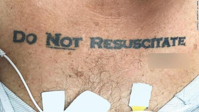 病院に運ばれた男性の胸には「蘇生しないで」というタトゥーが
