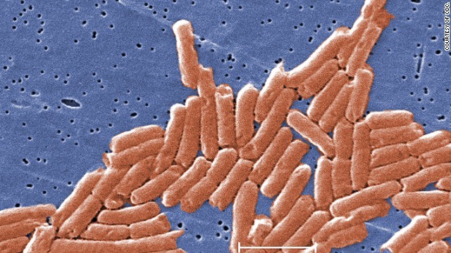 １６世紀に米大陸を襲った疫病はサルモネラ菌が原因か
