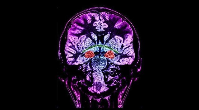 新たな脳細胞の形成は１３歳までに行われなくなるとの研究結果が発表された