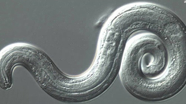 ムカデを調理せずに食べた2人が寄生虫に感染していたことが分かった