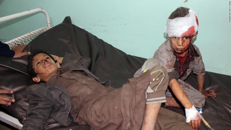 病院で手当てを受ける負傷した子どもたち/STRINGER/AFP/Getty Images