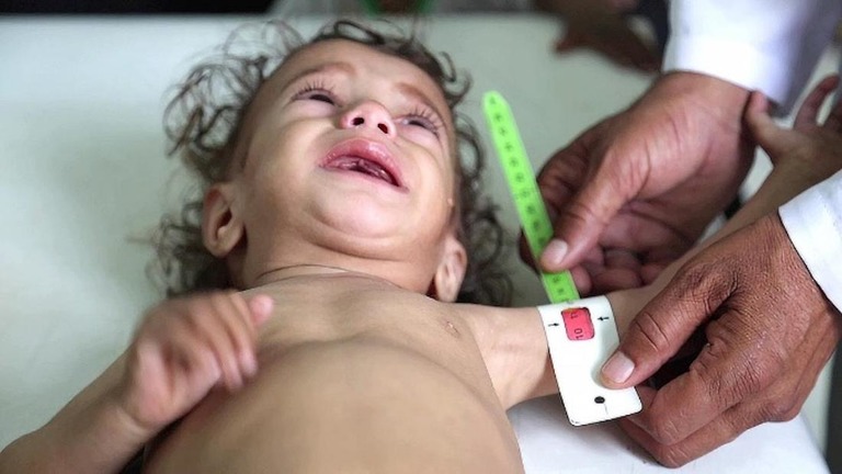 「セーブ・ザ・チルドレン」が、イエメンで子ども５００万人が飢餓状態に陥る恐れがあると警告している