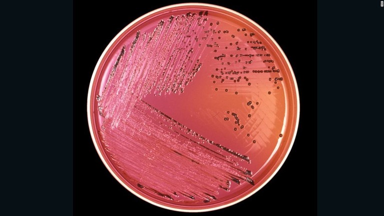 サルモネラの耐性菌感染が広がり、２９州で少なくとも９２人の患者が確認された/CDC