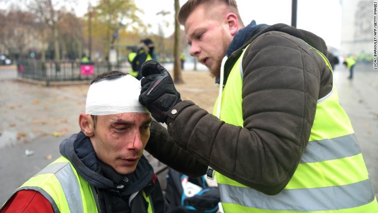 負傷して手当てを受けるデモ参加者/Lucas Barioulet/AFP/Getty Images