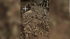 新石器時代の人間の骨からペスト菌、人口激減の謎解明か　スウェーデン
